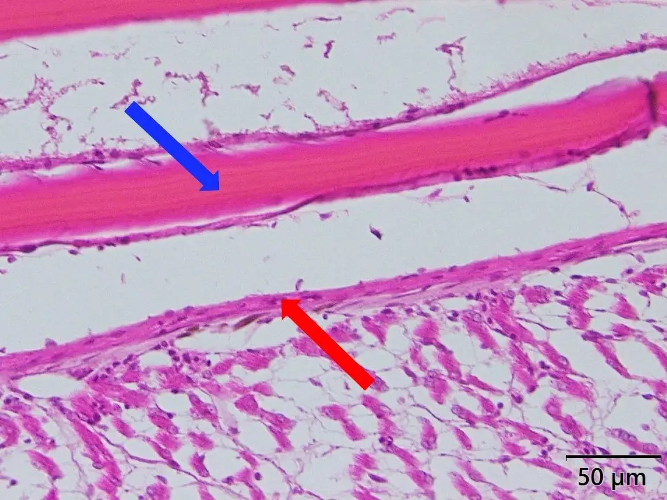 松かさ病キンギョの体表で見られた鱗嚢浮腫