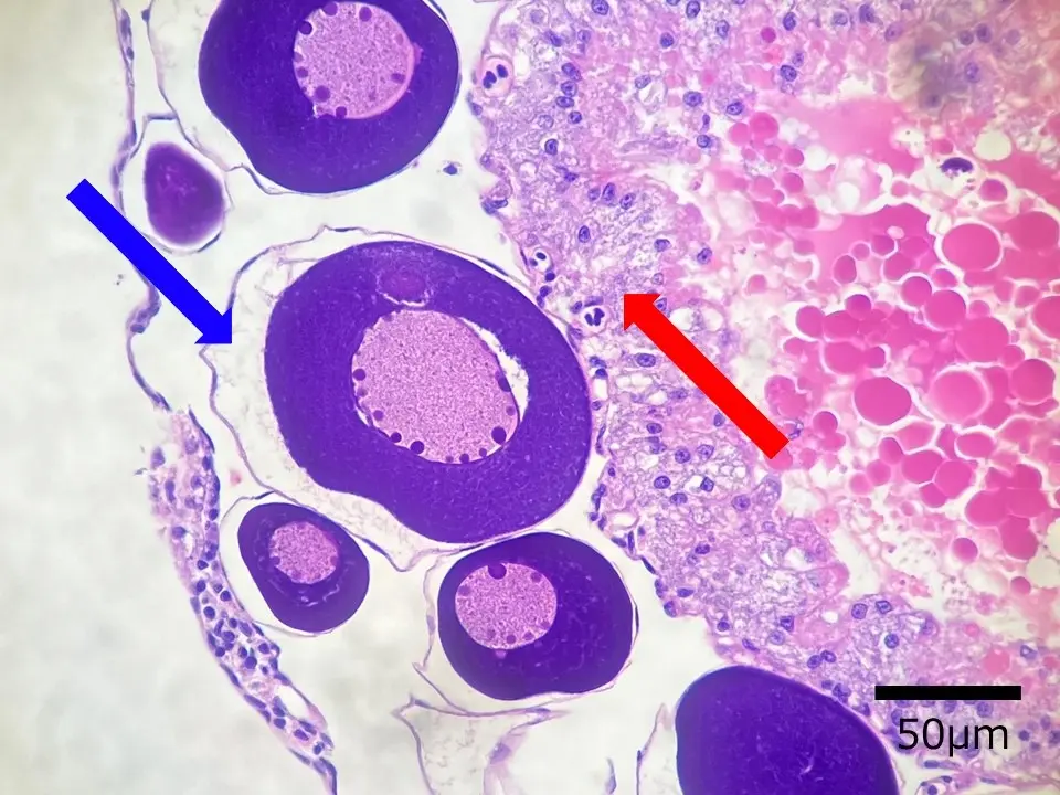 松かさ病キンギョの卵巣で見られた異常