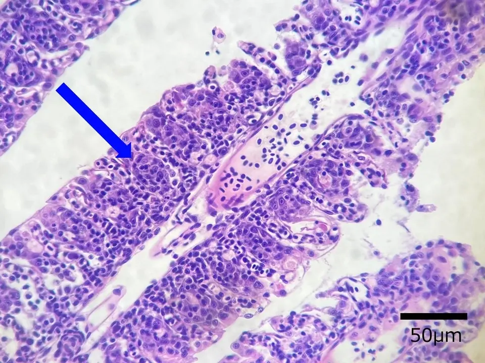 松かさ病キンギョの鰓で見られた異常